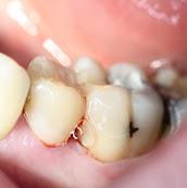 CM Dental ltd image 10